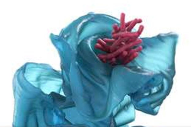 Tuberkulose Animation